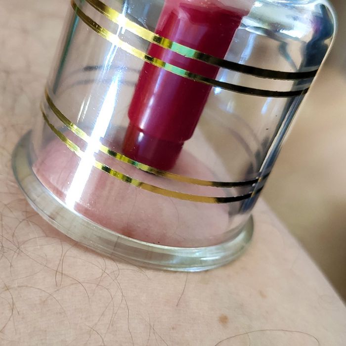 Cupping set s črpalko, 17 plastičnih skodelic, v kovčku